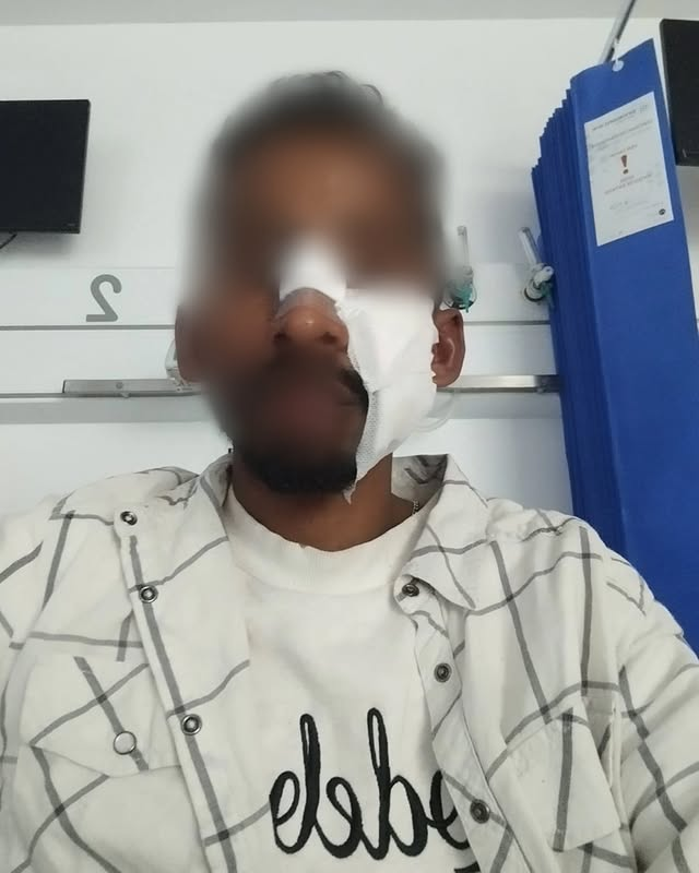 Agressão racista em Guimarães